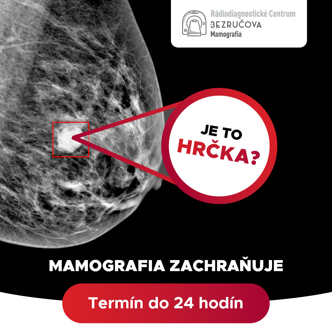 Mamografia