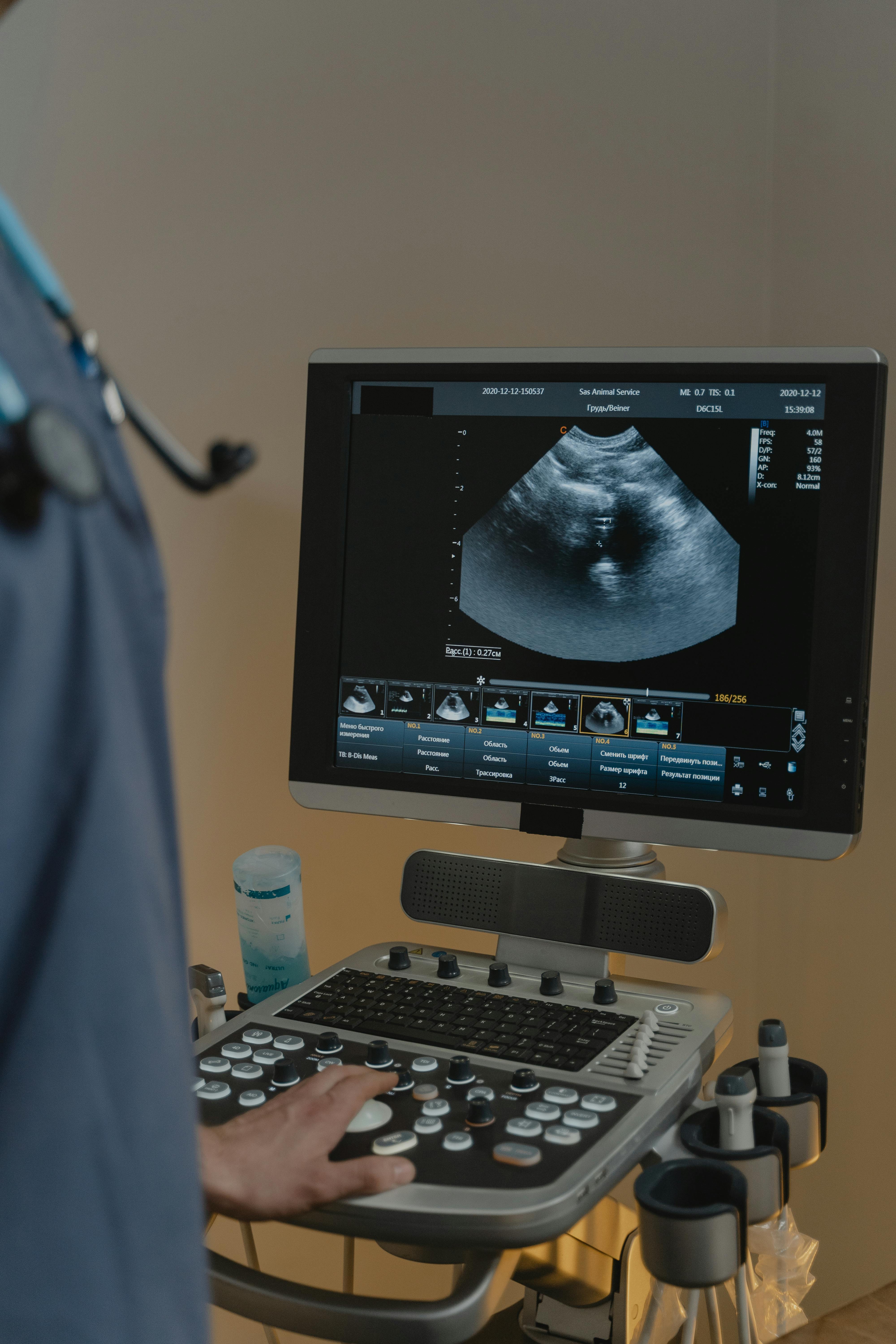 sonografia