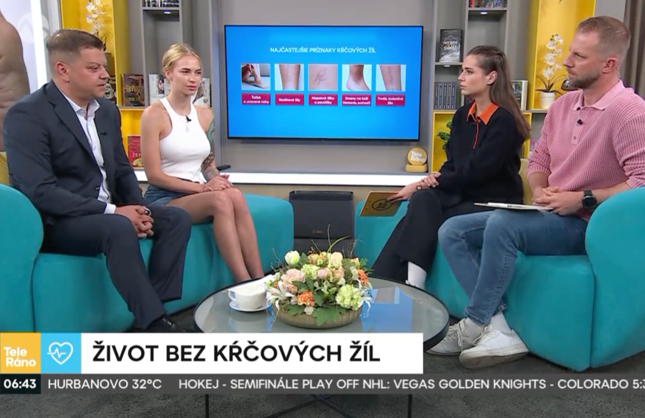 život bez kŕčových žíl